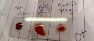 practical blood group determination